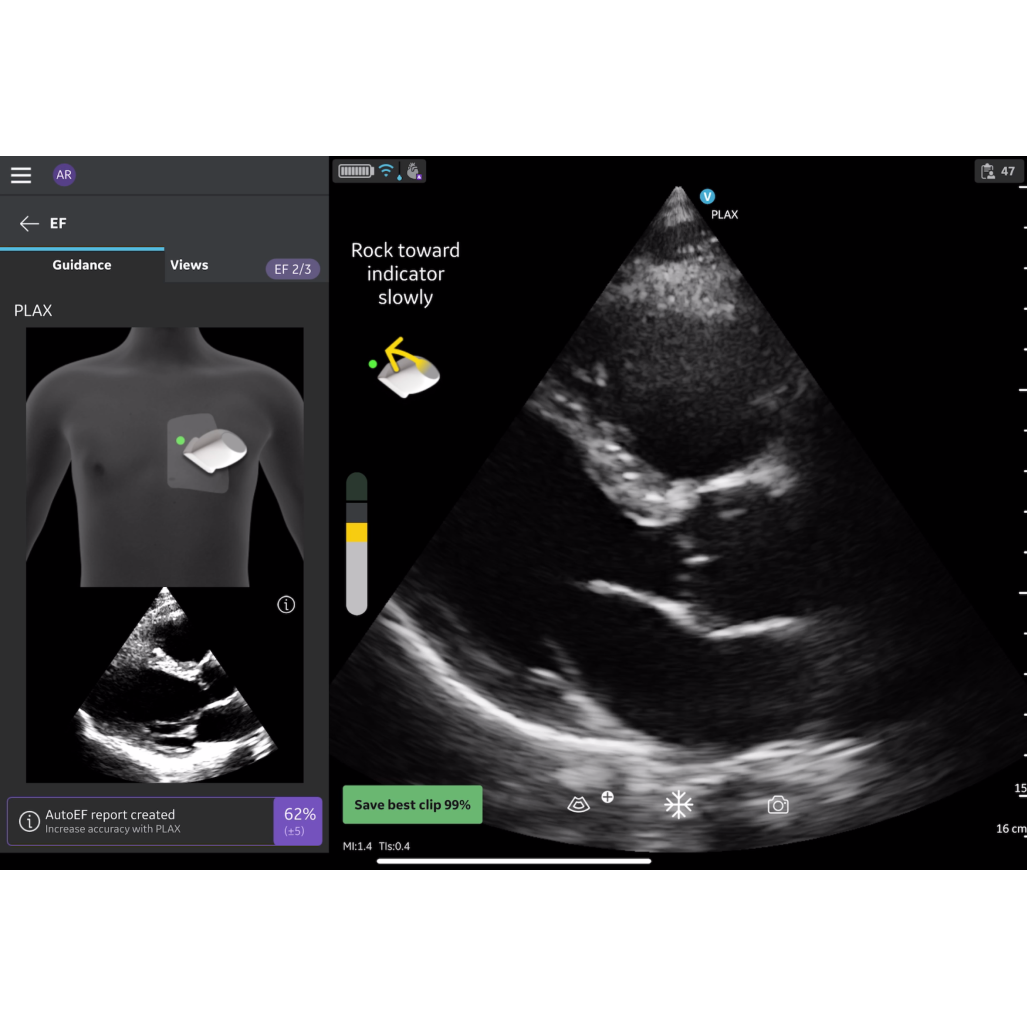 Vscan Air SL Caption AI (Stand-alone) FlexiPackage EUR